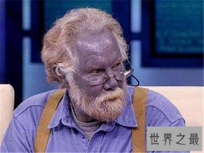 ​蓝色人种真实存在 皮肤变成蓝色竟然和血液有关