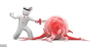 ​什么是腮腺肿瘤？早期发现这个症状应及时就医