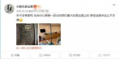 ​张云雷手术顺利，成功取出三十余枚钢钉，晒图报平安惹众人心疼