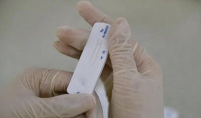 ​抗原检测怎么做？抗原检测试剂盒使用方法