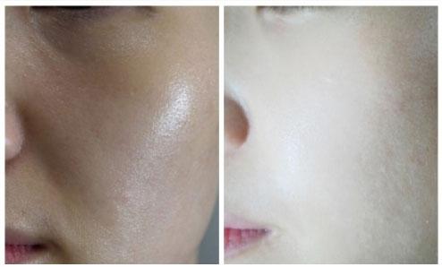 南光贵妇美白针多少一个疗程（萧菲说整形美白针的）(5)