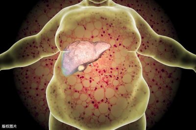 ​脂肪肝要吃些什么好 脂肪肝要吃些什么菜