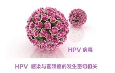 ​看过来，教你快速读懂“宫颈癌”筛查报告