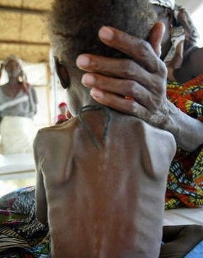 非洲贫困地区饱受摧残的孩子们,有时牛粪也能成为他们的食物