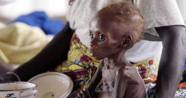 非洲贫困地区饱受摧残的孩子们,有时牛粪也能成为他们的食物