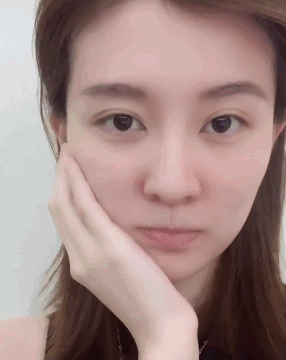 明星拔智齿的脸型变化图（周冬雨拔完智齿脸肿成）(4)