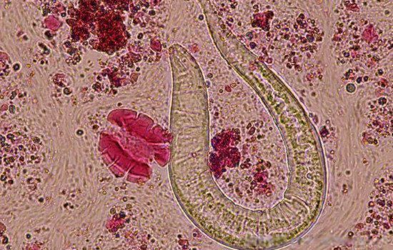 玉米男孩图片是什么病 抠虫子原图确实很恐怖
