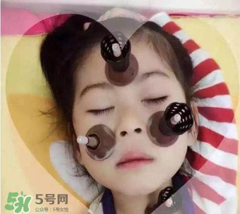 艾灸贴可以治咳嗽吗？艾灸贴可以治退烧吗？